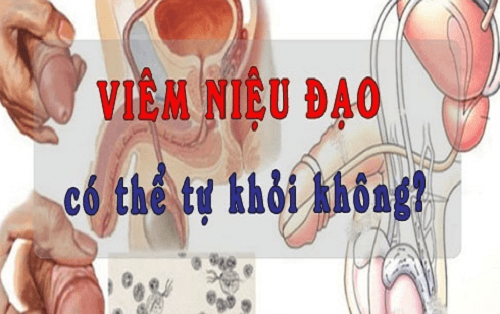Viêm niệu đạo ở nam, nữ không thể tự khỏi nếu không phát hiện và điều trị kịp thời