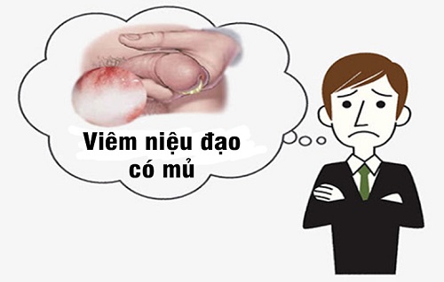Viêm niệu đạo mủ