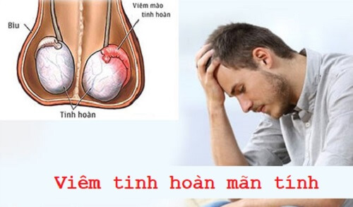 Viêm tinh hoàn mãn tính 