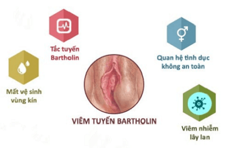 Viêm tuyến Bartholin có nguy hiểm không?