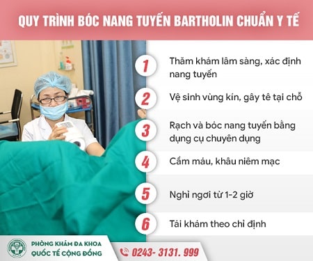 Phương pháp điều trị viêm tuyến bartholin nhanh chóng, hiệu quả