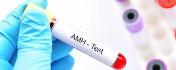 Xét nghiệm AMH
