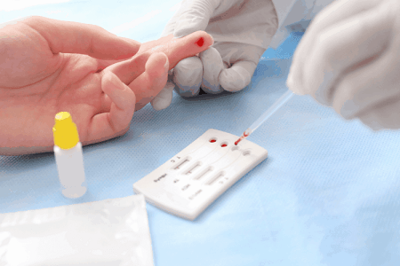 Xét nghiệm bệnh giang mai