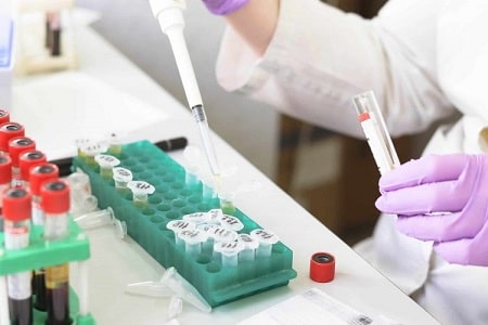 Các phương pháp xét nghiệm mụn rộp sinh dục hiện nay