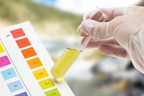 Xét nghiệm nước tiểu chuẩn đoán viêm tinh hoàn phải