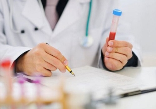 Xét nghiệm sùi mào gà bao lâu có kết quả?