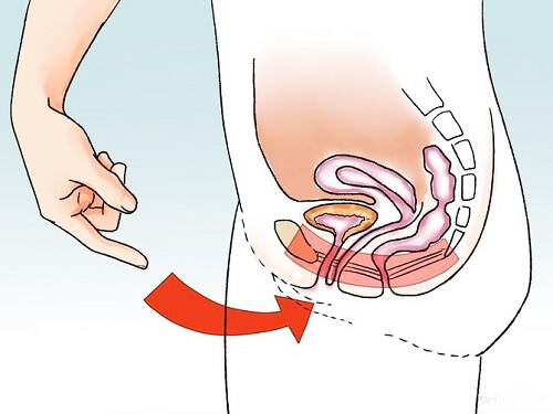 Không xuất tinh được - Biểu hiện bệnh xuất tinh ngược